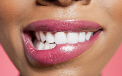 Whitening Your Teeth Professionally