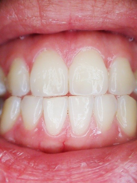 Ways to Detect and Prevent Gum Recession
