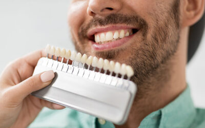 What are the benefits of veneers, and what issues do they fix?