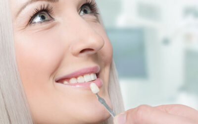 Teeth Whitening vs. Veneers: Which One is Best for You?